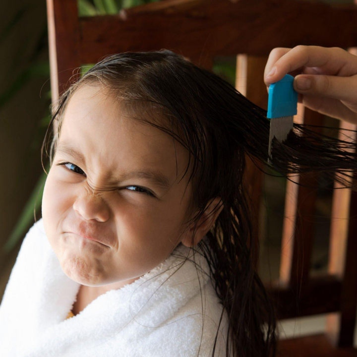 Hempas Kutu Rambut dengan Cuka Apel, Bisakah?